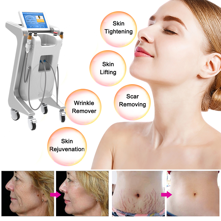 2021-Նորագույն-fractional-rf-microneedle-machine-and-Body-Radiofrequency-Microneedle-Beauty-Equipment-skin-care-machine