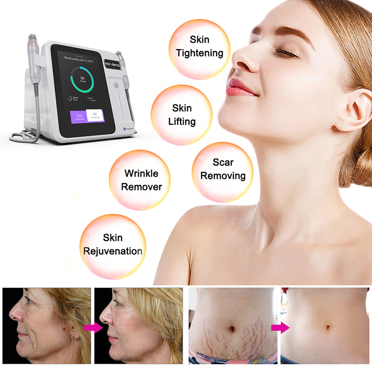 2021-ប្រភាគ-rf-microneedle-machine-and-Body-Radiofrequency-Microneedle-Beauty-Equipment-skin-care-machine