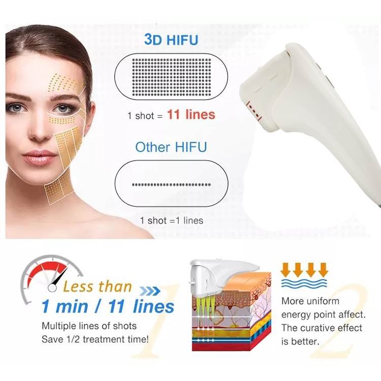 Nešiojamas 3D HIFU 4MHz odą stangrinantis veido pakėlimo aparatas2