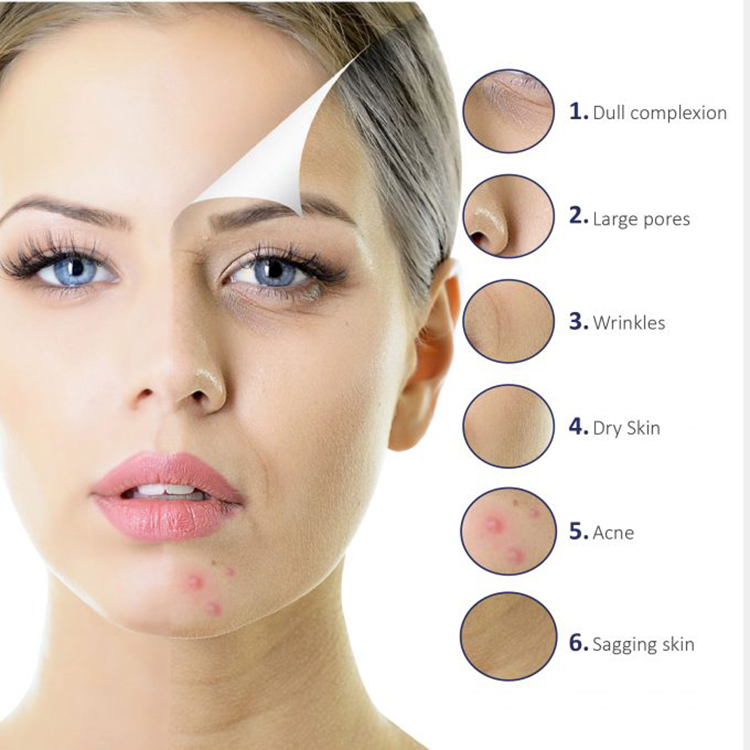urządzenie-rozświetlające-skórę-pielęgnację-twarzy-hydra-dermabrazja23