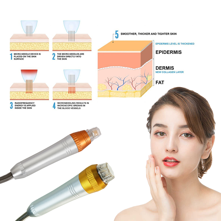Microneedling_for_acne_scars-бадан