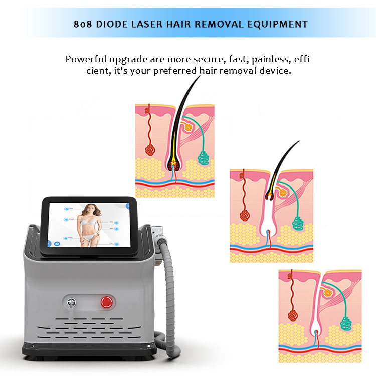portable 808 hair removal machine (4)
