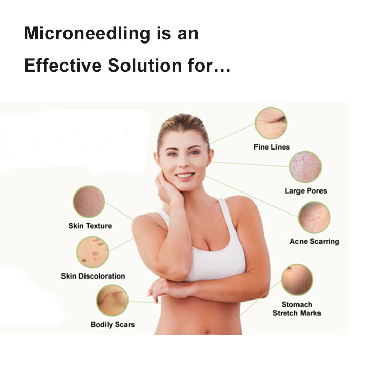 rf-microneedling-ເຄື່ອງ 1