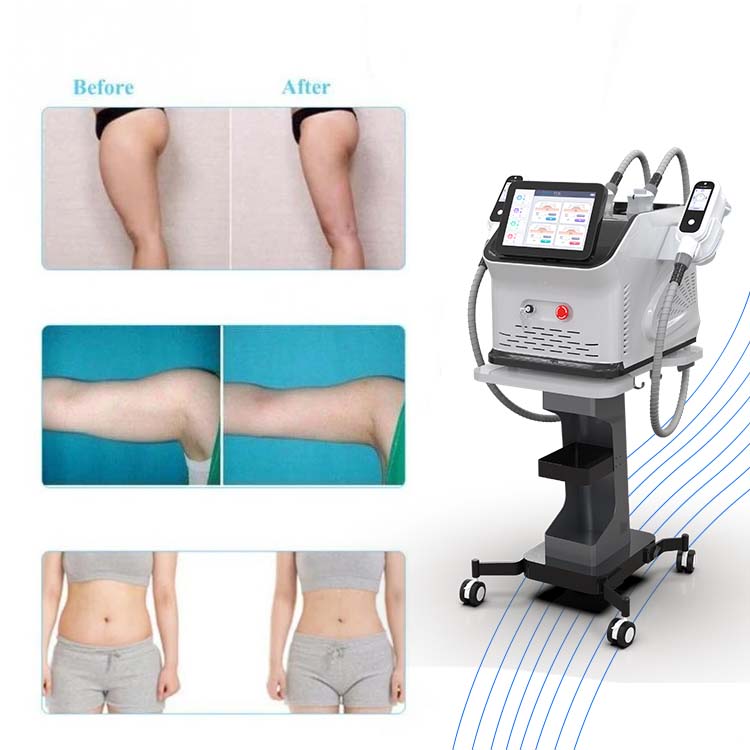 4-Types-Fat-Freezing-Machine-Fat-Freeze-Body-Slimming-Weight-Loss-Lipo-Anti-Cellulite-Dissolve-Fat_